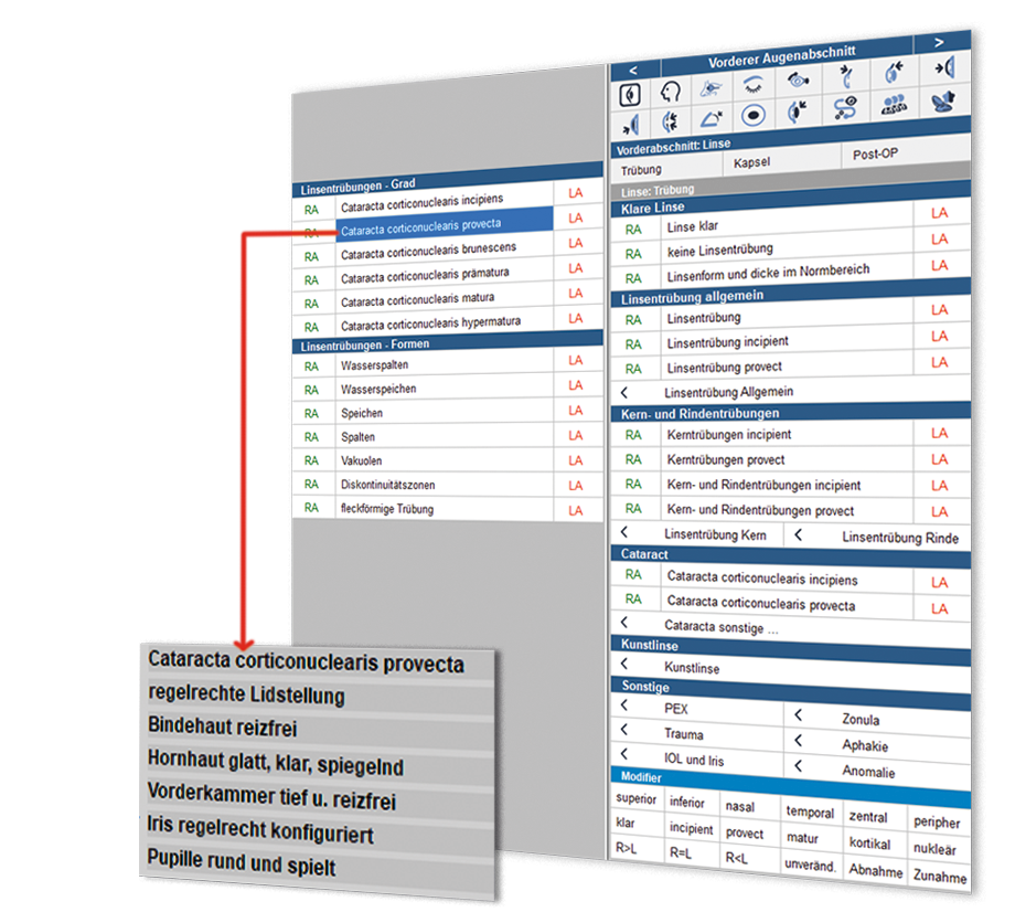 Abbildung Userinterface, ifaLION+ PVS mit intuitiver Benutzerführung auf Grundlage ophthalmologischer Fachtiefe